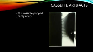 CASSETTE ARTIFACTS
• This cassette popped
partly open.
 