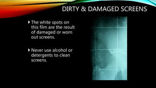 DIRTY & DAMAGED SCREENS
 The white spots on
this film are the result
of damaged or worn
out screens.
 Never use alcohol or
detergents to clean
screens.
 