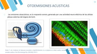 OTOEMISIONES ACUSTICAS
18
o Las emisiones otoacústicas, es la respuesta sonora, generada por una actividad neuro-eléctrica de las células
pilosas externas del órgano de Corti.
Nuñez F, cols. Incidencia de hipoacusia secundaria a hiperbilirrubinemia en un programa de cribado auditivo neonatal universal basado en otoemisiones acústicas y potenciales
evocados auditivos. Acta Otorrinolaringol Esp. 2008;59(3):108-13.
 