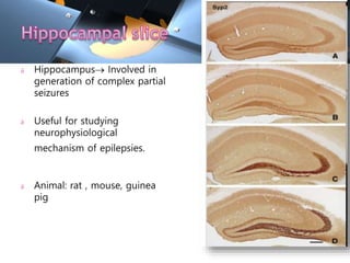 Screening antiepileptics | PPTX