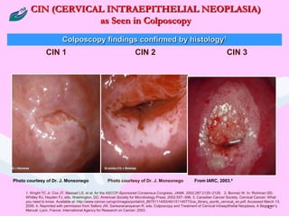 screening_and_prevention protocols for_cervix.ppt