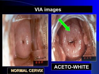ACETO-WHITEACETO-WHITE
VIA imagesVIA images
 