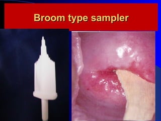Broom type samplerBroom type sampler
 