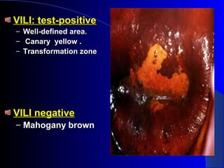 VILI:VILI: test-positivetest-positive
– Well-defined area.Well-defined area.
– Canary yellow .Canary yellow .
– Transformation zoneTransformation zone
VILI negativeVILI negative
– Mahogany brownMahogany brown
 