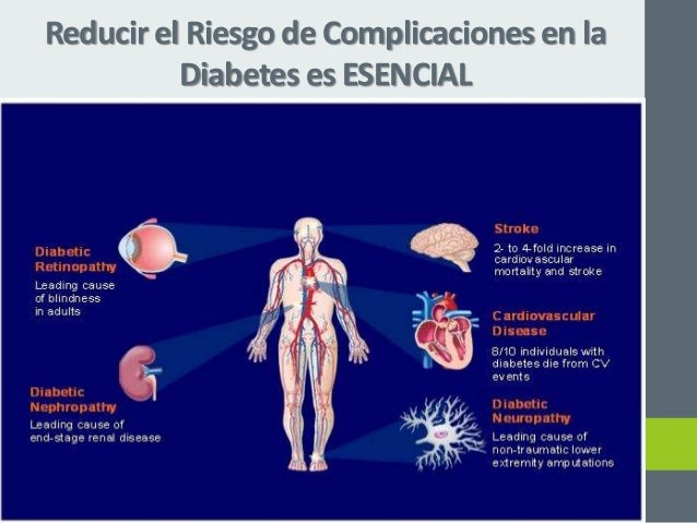 Screening Complicaciones Vasculares en Diabetes Mellitus Screening Complicaciones Vasculares en Diabetes Mellitus