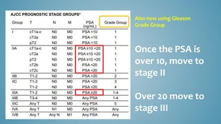Once the PSA is
over 10, move to
stage II
Over 20 move to
stage III
Also now using Gleason
Grade Group
 