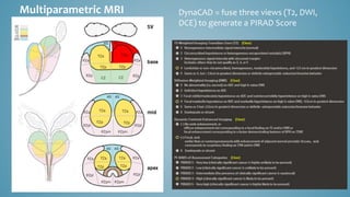 Multiparametric MRI DynaCAD = fuse three views (T2, DWI,
DCE) to generate a PIRAD Score
 