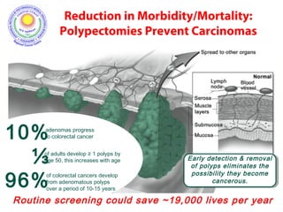 Polypectomies Screening in colorectal cancers dr. ashutosh | PPT
