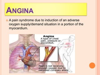 ANGINA
 A pain syndrome due to induction of an adverse
oxygen supply/demand situation in a portion of the
myocardium.
 