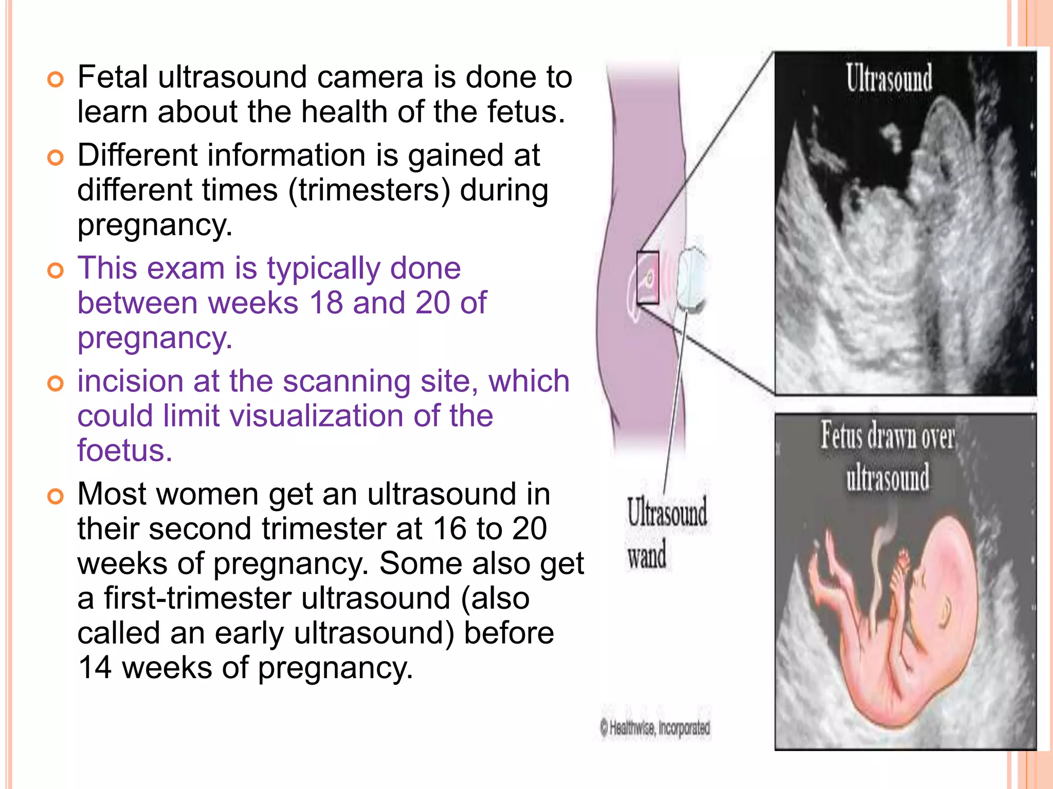 SCREENING OF HIGH RISK PREGNANCY NEWER MODALITIES OF_110313.pptx