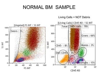 NORMAL BM SAMPLE
Living Cells = NOT Debris
 