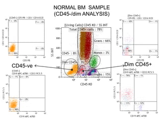 Dim CD45+CD45-ve
NORMAL BM SAMPLE
(CD45-/dim ANALYSIS)
 