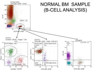 NORMAL BM SAMPLE
(B-CELL ANALYSIS)
 