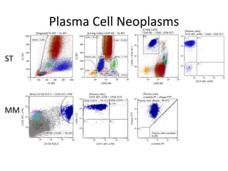 Plasma Cell Neoplasms
ST
MM
 