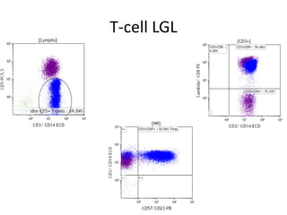T-cell LGL
 