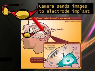 Camera sends images
to electrode implant
 