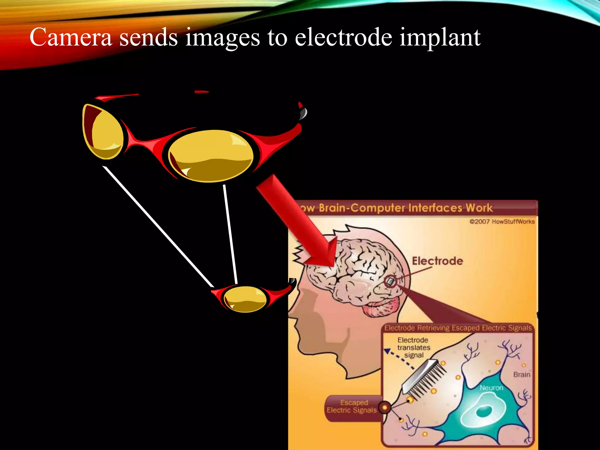 Camera sends images to electrode implant
 