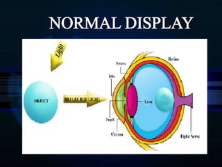 Screenless display technology ppt | PPTX