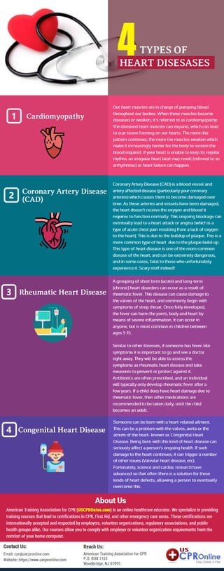 Four Most Common Types of Heart Diseases