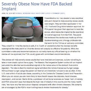 Michael McKenna West Hartford - Severely Obese Now Have FDA Backed Implant