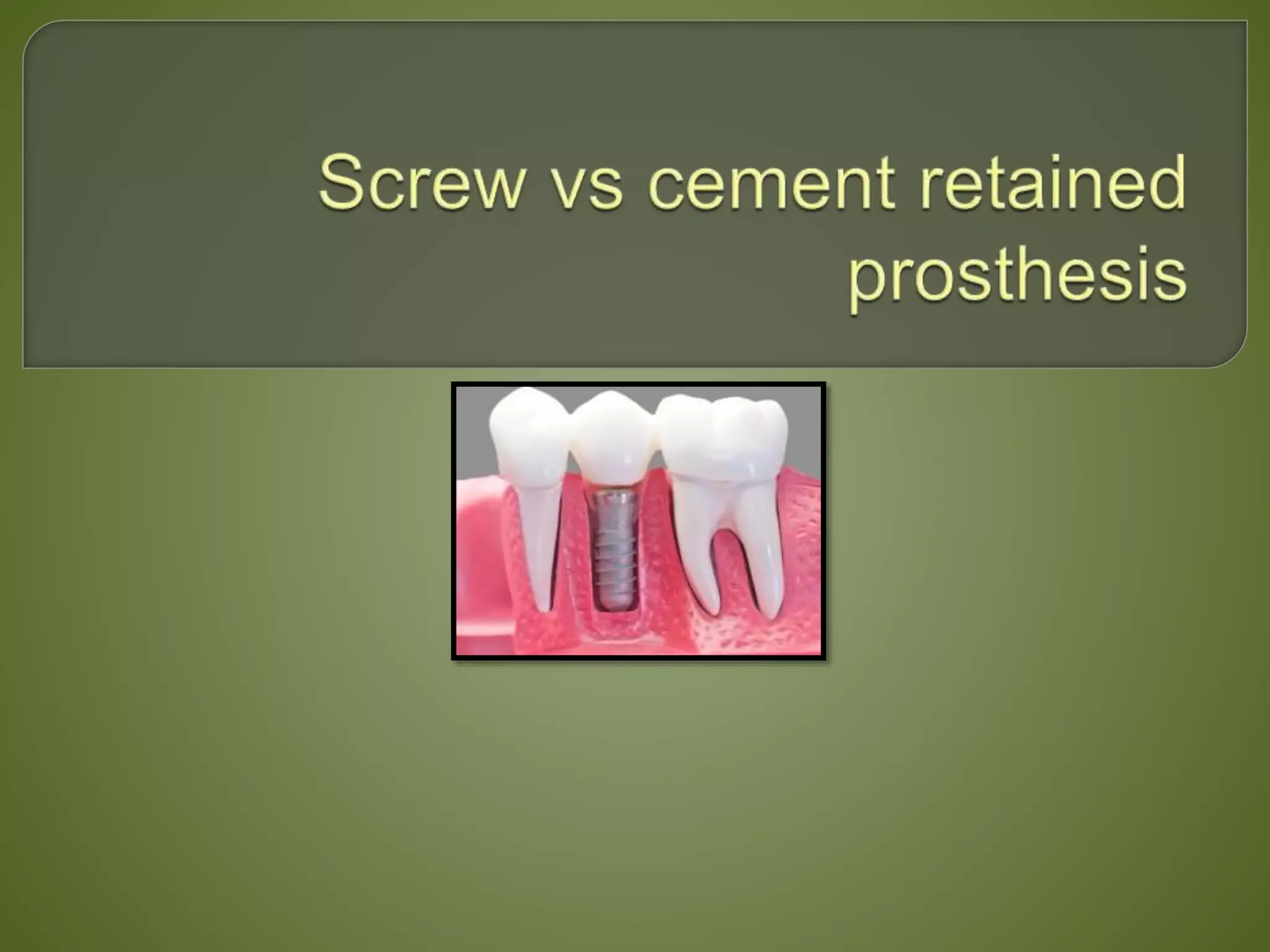 Screw retained vs cement retained prosthesis.pptx