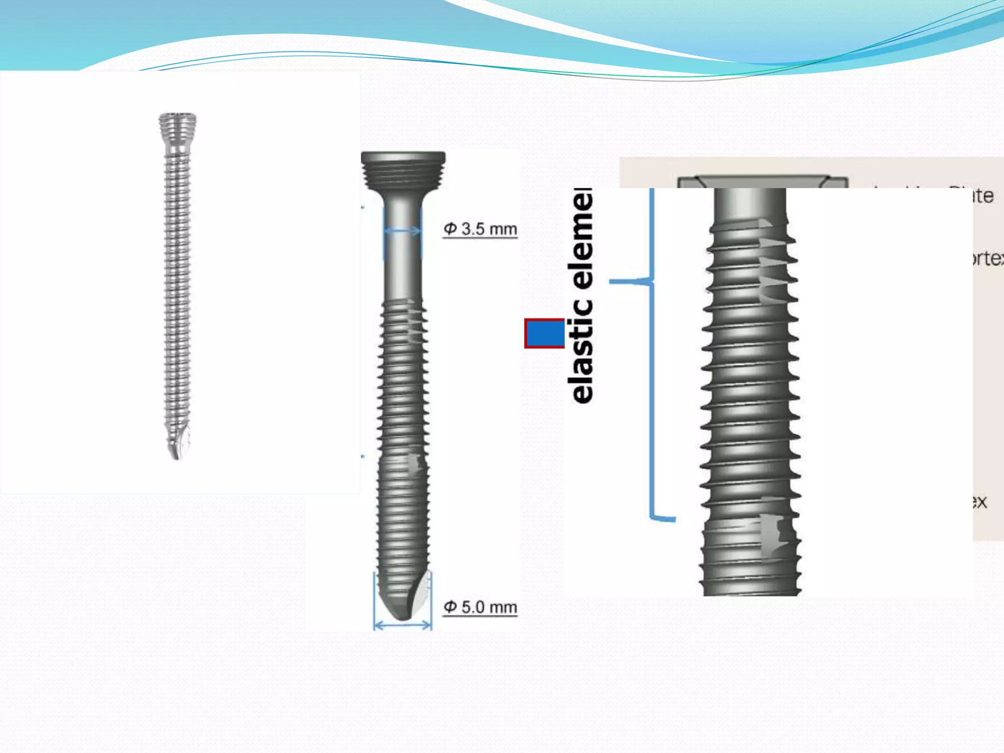 SCREWS in orthopaedic surgery.pptx