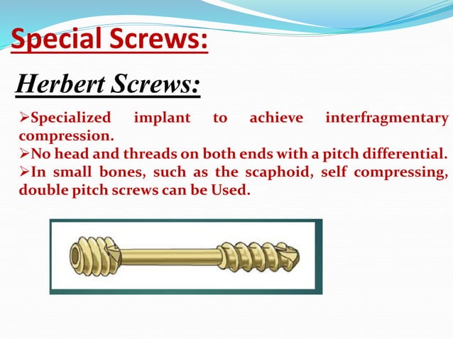 SCREWS in orthopaedic surgery.pptx | Needlework | Arts and Crafts