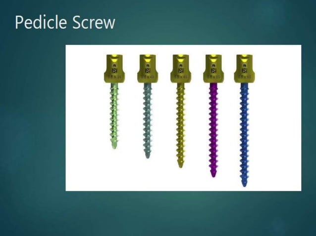 SCREWS in orthopaedic surgery.pptx | Needlework | Arts and Crafts