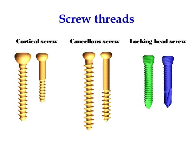 Screws And Plates Fixation screws-and-plates-fixation