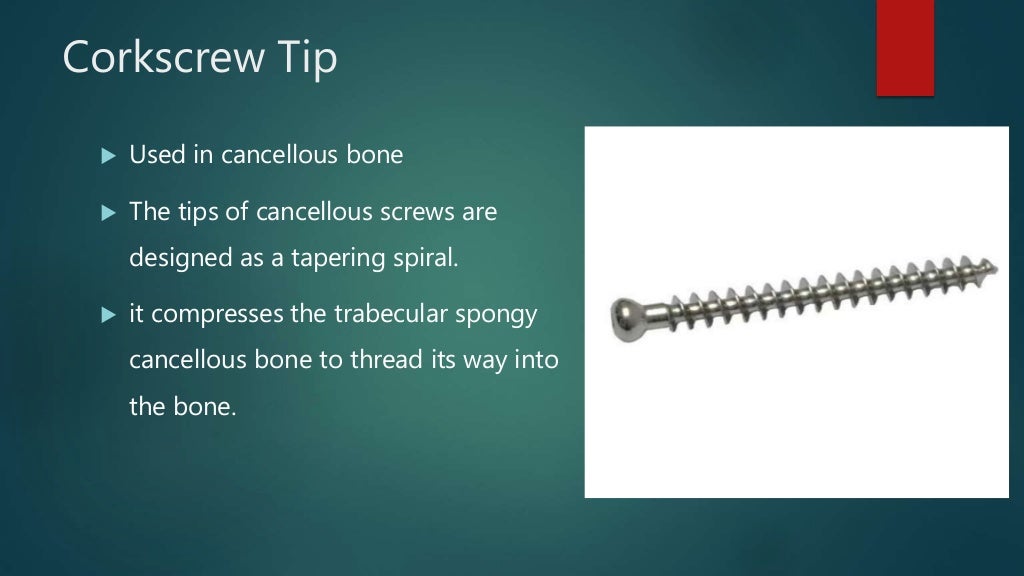 Basics of Screws in Orthopedics