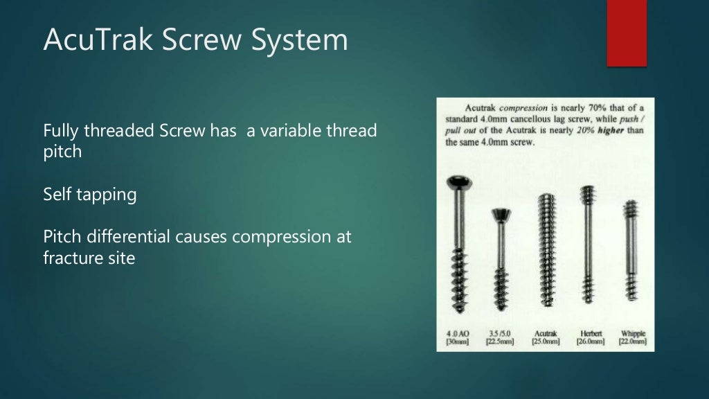 Basics of Screws in Orthopedics