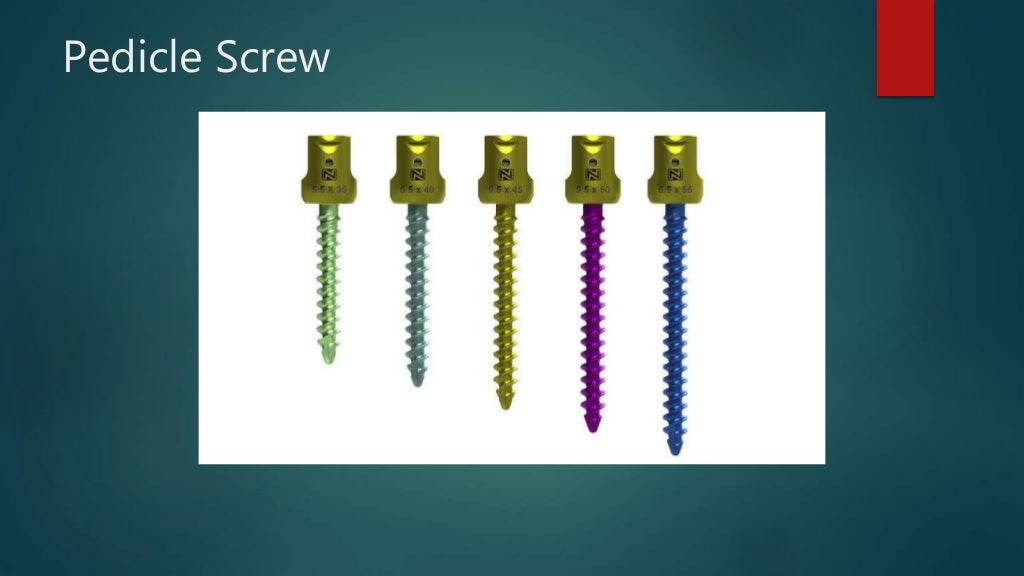 Basics of Screws in Orthopedics