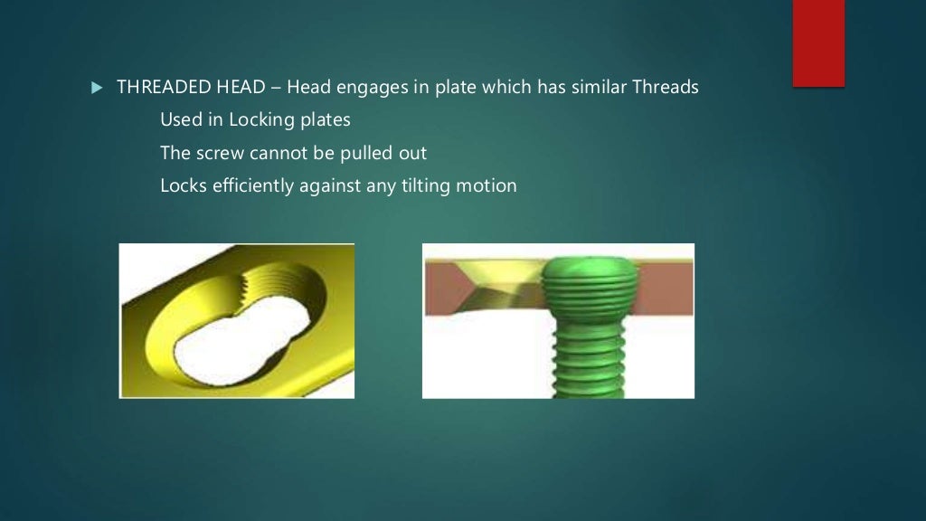 Basics of Screws in Orthopedics