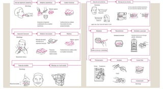 protesis total pasó a paso