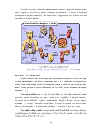 În ordinea frecvenţei tuberculoza extrapulmonară afectează: ganglionii limfatici, pleura,
tractul urogenital, articulaţiile şi oasele, meningele şi peritoneul. Ca urmare a diseminării
hematogene la indivizii seropozitivi HIV, tuberculoza extrapulmonară este întâlnită astăzi mai
frecvent decât în trecut. (Figura 12)
Figura 12: Tuberculoza extrapulmonară
http://medchrome.com/wp-content/uploads/2016/03/tuberculosis.gif accesat 11.11.2018
În cursul primoinfecției se realizează prin diseminarea hematogenă sau de la un focar
reactivat, extrapulmonar. Este gravă, cu mortalitate mare. IDR la tuberculină este destul de des
negativ, cauza fiind infecția recentă sau imunitatea scăzută și astfel lasă loc dezvoltării bolii.
Reacția devine pozitivă în cursul tratamentului în cazul unei evoluții favorabile (argument
retrospectiv). [15]
Tuberculoza miliară este cea mai frecventă forma de tuberculoză diseminată având
numeroase leziuni tuberculoase mici (sub 3 mm), active, răspândite în întregul organism,
frecvent la nivelul plămânilor, rinichilor, suprarenalelor, splinei și ficatului, măduvei osoase,
seroaselor (ex. meninge), sistemului nervos central. Termenul de granulie este utilizat atunci
afectarea este difuză fără să fie predominant pulmonară. Clinic poate fi acută sau cronică.
Tuberculoza miliară acută, este progresivă rapid și fatală fără un tratament eficient;
mortalitatea poate fi ridicată chiar și cu tratament eficient. Poate fi prezentă la orice vârstă dar
este frecventă adult tânăr dar și la copil.
28
 