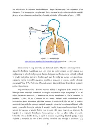 sau introducerea de substanțe medicamentoase. Scopul bronhoscopiei este explorator și/sau
diagnostic. Prin bronhoscopie este observată direct mucoasa bronșică și se pot efectua recoltări
de probe și secreții pentru examinări bacteriologice, citologice și histologice. (Figura 15) [23]
Figura 15: Bronhoscopie
http://www.cdt-babes.ro/articole/bronhoscopia.phpaccesat 18.11.2018
Bronhoscopia în scop terapeutic se efectuează pentru eliberarea cailor respiratorii
desecretii abundente, îndepărtarea unor corpi străini de origine exogenă sau introducerea unor
medicamente în arborele traheobronsic. Pentru efectuarea unei bronhoscopii, asistență medicală
va pregăti materialele necesare: bronhoscopul ales de medic cu anexele corespunzătoare,
aspiratorul electric cu sondele respective, casoleta cu tampoane și comprese sterile, substanțe
anestezice (Xilină 2-4%, Pantocaina 1%), medicamente de urgență în caz de accidente, aparatură
pentru oxigenoterapie.
Pregătirea bolnavului: Asistenta medicală trebuie să pregătească psihic bolnavul, să îl
convingă asupra necesității examenului, să-i asigure un climat de liniște, de siguranță. În caz de
nevoie, la indicăția medicului, că administra un sedativ. Examinarea se face de dimineață cu
pacientul “a jeun”, iar cu o jumătate de ora înainte, medicul indica administrarea unor
medicamente pentru diminuarea secretiilor bronșice și atenuareareflexului de tușe. În vederea
administrării anestezicului, asistență medicală va explică bolnavului necesitatea colaborării lui la
reușită examenului, în special indicația de a respiră regulat, despre gustul anestezicului, despre
senzația de îngroșare a gâtului, limbii, ceea ce poate să-i creeze impresia de disconfort la
înghițire și la respirație. Introducerea bronhoscopului se face de către medic, iar poziția
bolnavului este de decubit dorsal, cu capul în extensie, cu gură larg deschisă, poziție ce este
asigurată și menținută de către a două asistență medicală care participa la examinare. [23]
57
 
