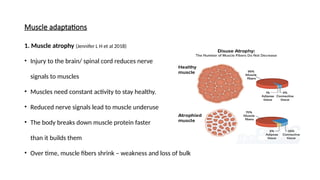 Neuroplasticity and Musculoskeletal Adaptation in Neurological Sciences ...