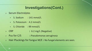 Scrofuloderma Presentation Scrofuloderma semi final-1.pptx