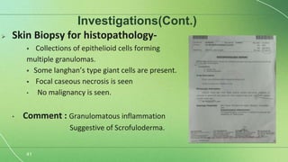 Scrofuloderma Presentation Scrofuloderma semi final-1.pptx