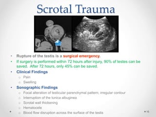 Testicle Injuries Scrotal 2013.ppt