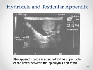 Scrotal 2013.ppt