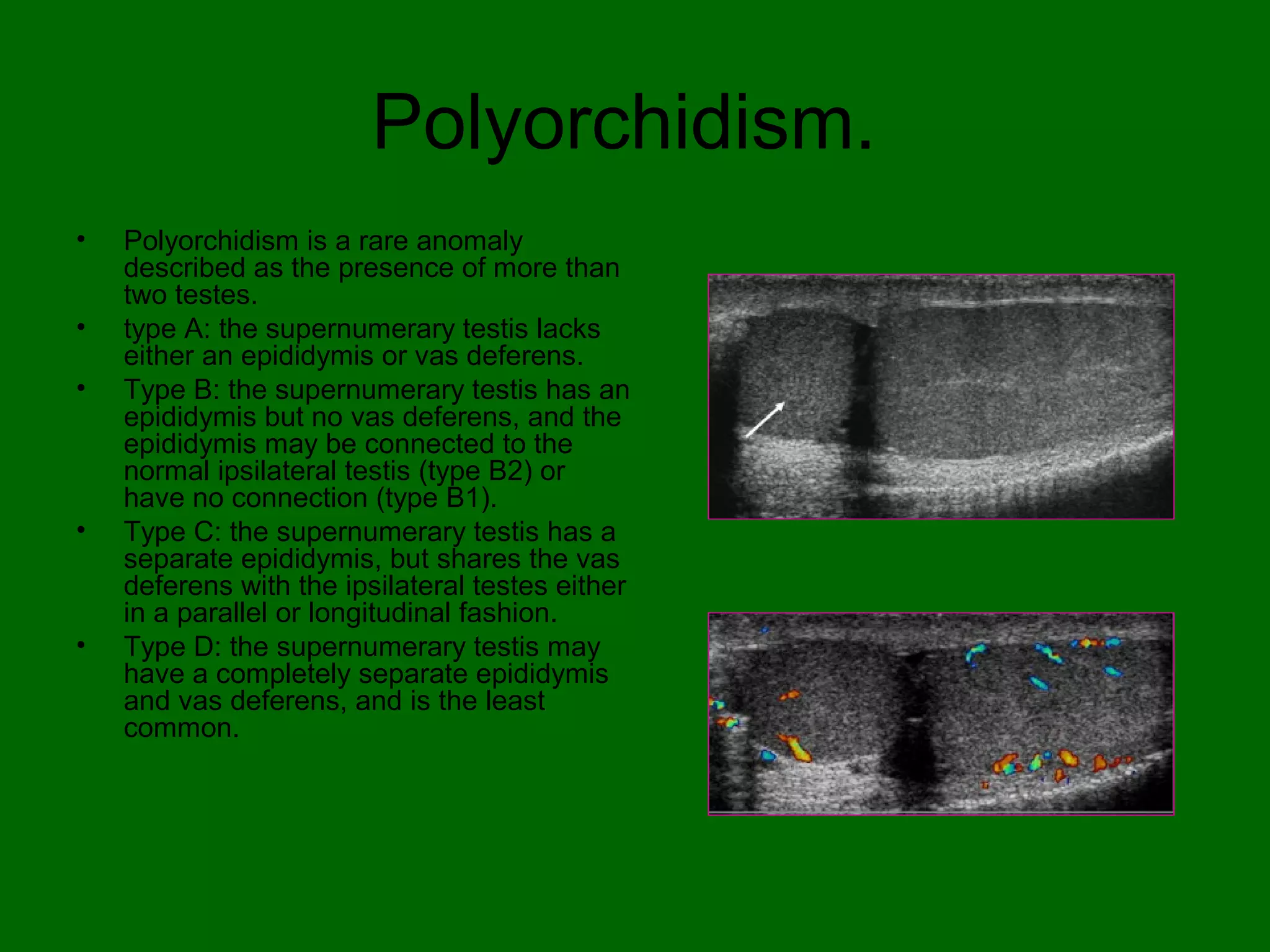 Scrotal 4 t's | PPT
