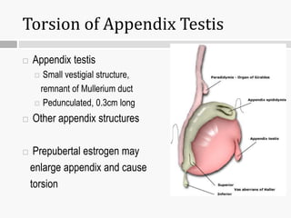 Torsion of Appendix Testis
 Appendix testis
 Small vestigial structure,
remnant of Mullerium duct
 Pedunculated, 0.3cm long
 Other appendix structures
 Prepubertal estrogen may
enlarge appendix and cause
torsion
 