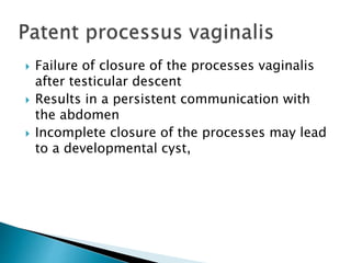  Failure of closure of the processes vaginalis
after testicular descent
 Results in a persistent communication with
the abdomen
 Incomplete closure of the processes may lead
to a developmental cyst,
 