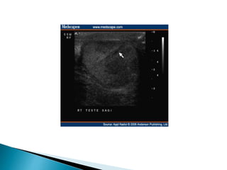 Scrotal disorders