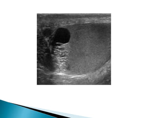 Scrotal disorders