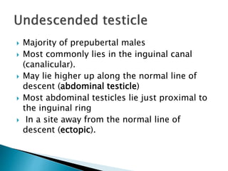  Majority of prepubertal males
 Most commonly lies in the inguinal canal
(canalicular).
 May lie higher up along the normal line of
descent (abdominal testicle)
 Most abdominal testicles lie just proximal to
the inguinal ring
 In a site away from the normal line of
descent (ectopic).
 