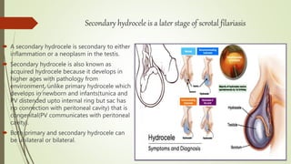 Hydrocleses Scrotal filariasis | PPTX