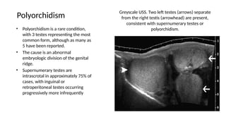 Discussion of the differential and radiological diagnosis of 60year old ...