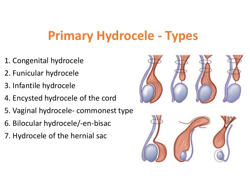 SCROTAL SWELLING SCROTAL SWELLING